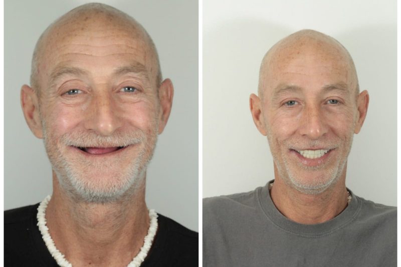 Before and After Art Dental
